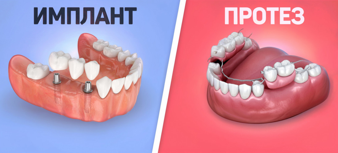 ks7n54dely8p24zbeoge9ttye5jcg2h0